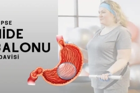 Yutulan Mide Balonu Fiyat