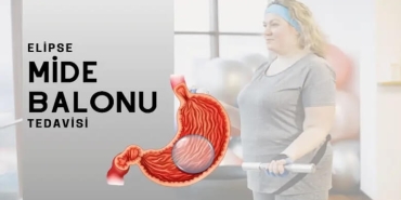 Yutulan Mide Balonu Fiyat