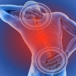 Omurga Kırıklarında Modern Tedavi