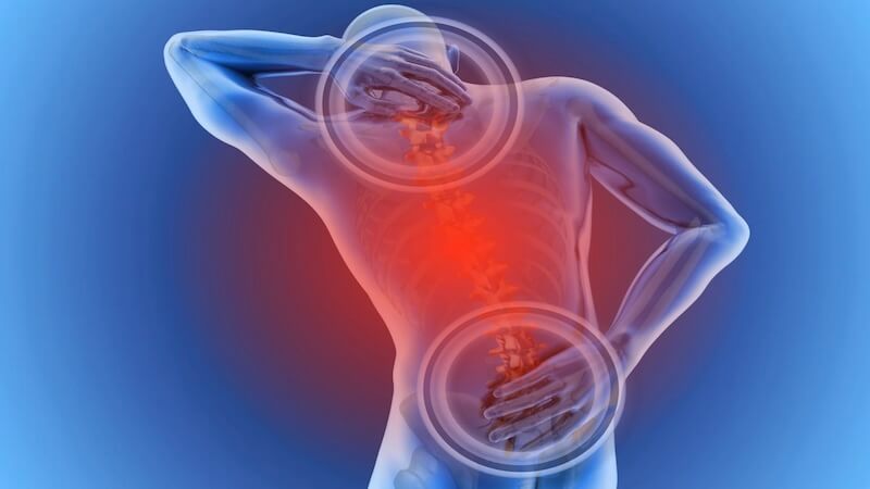 Omurga Kırıklarında Modern Tedavi